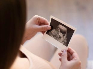 a pregnant girl holds in her hands a photo from an ultrasonic study of her unborn child